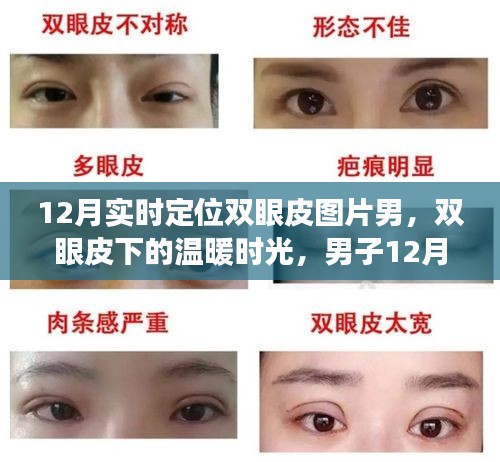 男子雙眼皮恢復(fù)之旅，冬季溫暖時(shí)光與友情的碰撞