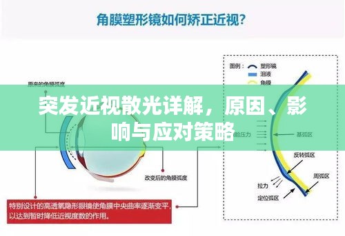 突發(fā)近視散光詳解，原因、影響與應(yīng)對策略
