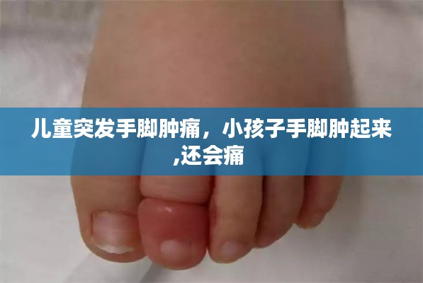 兒童突發(fā)手腳腫痛，小孩子手腳腫起來,還會(huì)痛 