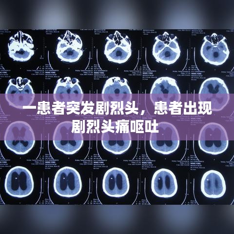 一患者突發(fā)劇烈頭，患者出現(xiàn)劇烈頭痛嘔吐 
