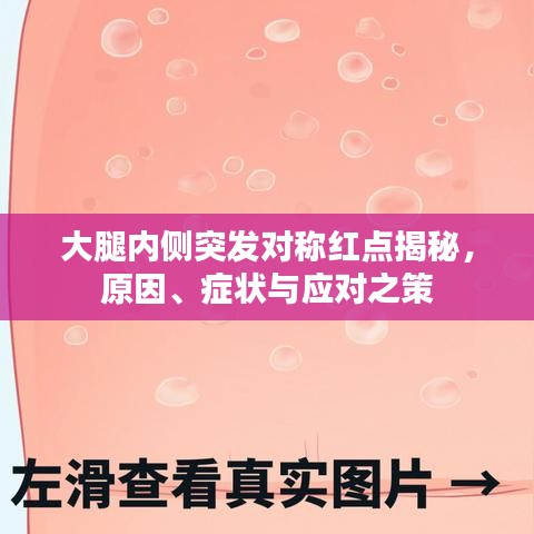 大腿內側突發(fā)對稱紅點揭秘，原因、癥狀與應對之策