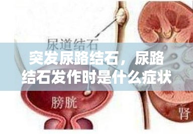 突發(fā)尿路結石，尿路結石發(fā)作時是什么癥狀? 