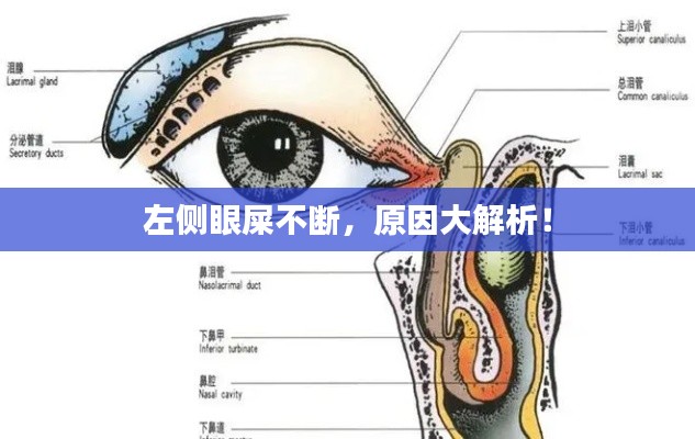 左側(cè)眼屎不斷，原因大解析！