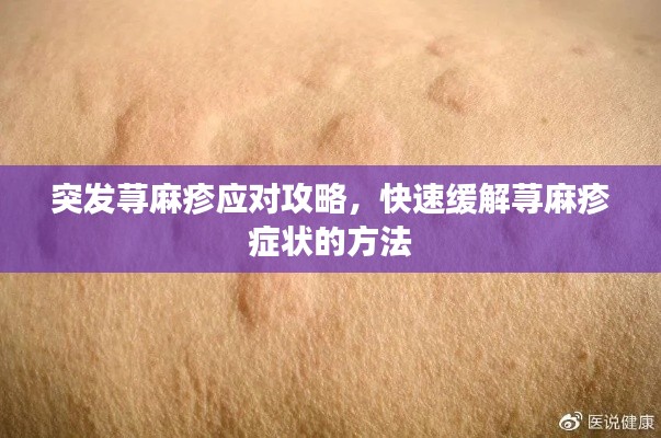 突發(fā)蕁麻疹應(yīng)對攻略，快速緩解蕁麻疹癥狀的方法