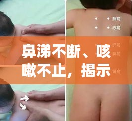 鼻涕不斷、咳嗽不止，揭示癥狀背后的健康隱患
