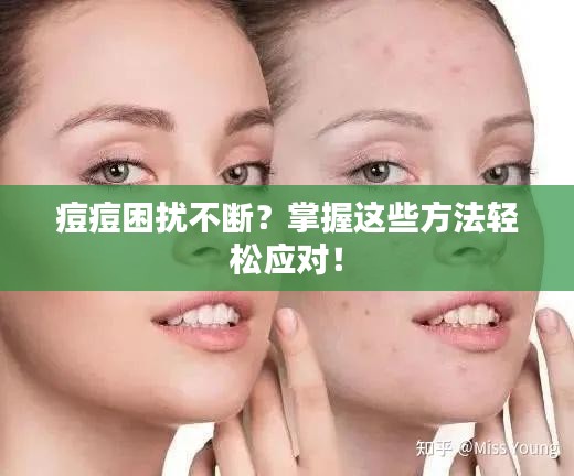 痘痘困擾不斷？掌握這些方法輕松應(yīng)對(duì)！