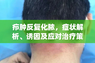 癤腫反復化膿，癥狀解析、誘因及應對治療策略